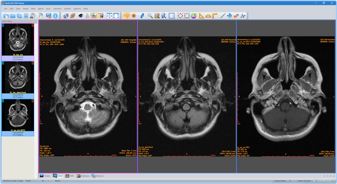 Sante DICOM Viewer Pro 14.0.11 JSeKNuTf_o