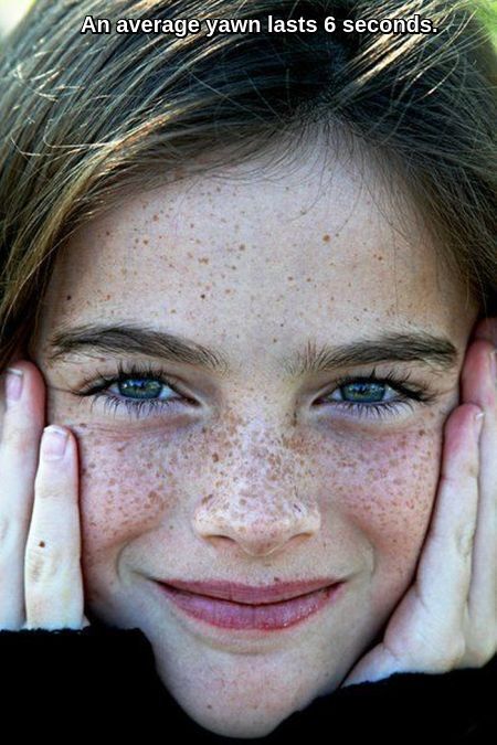 SEEING RED & FRECKLES pics 6 Ry2h3a32_o