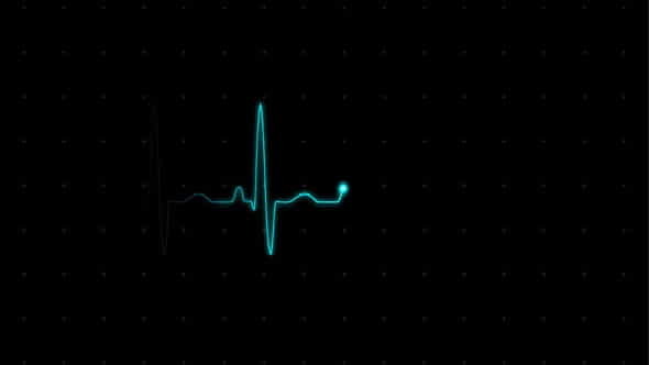 EKG (Heartbeat Monitor - Electrocardiogram) - VideoHive 615689