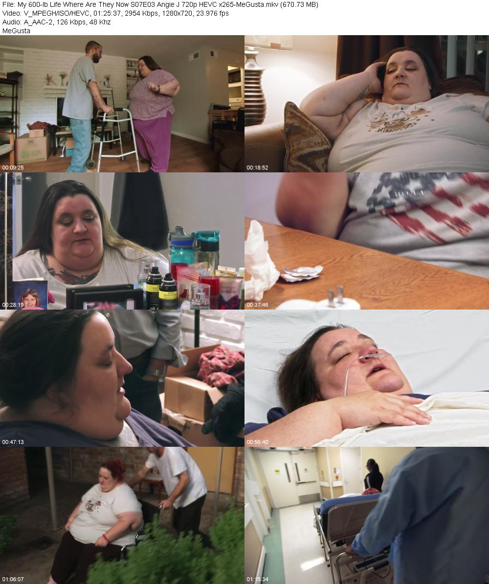 My 600 lb Life Where Are They Now S07E03 Angie J 720p HEVC x265