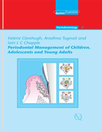 Periodontal Management Of Children, Adolescents, And Young Adults