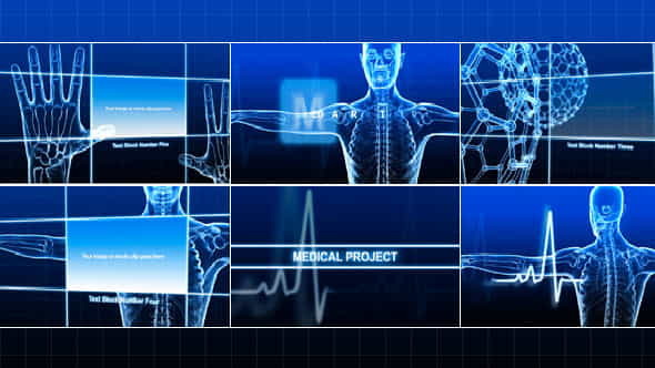 Medical Project - VideoHive 236064