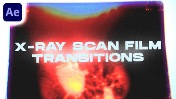 X-ray Scan Film - VideoHive 47852397