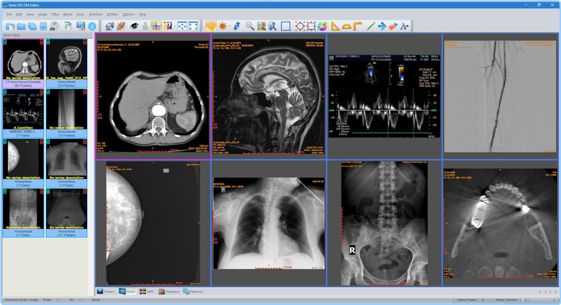 Sante DICOM Editor 10.0.9 SNmKTlPO_o