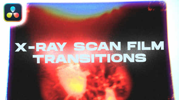 X-ray Scan Film - VideoHive 47852379