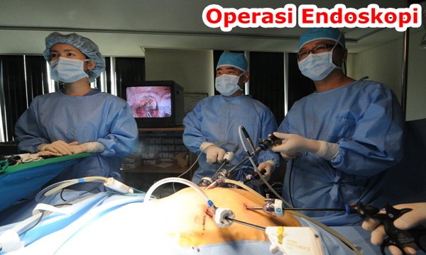 Informasi Operasi Endoskopi