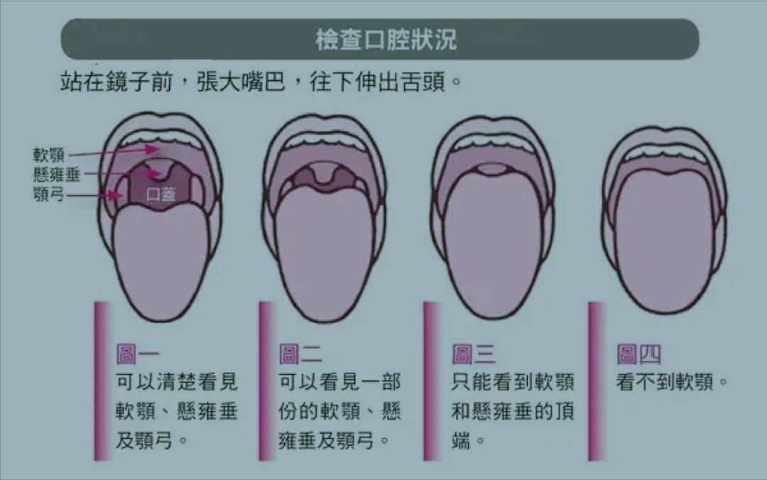 [討論] 大家看的到自己的懸雍垂嗎？