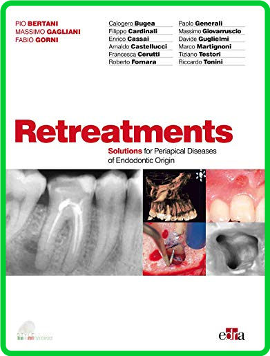 Retreatment  Solutions for apical diseases of endodontic origin