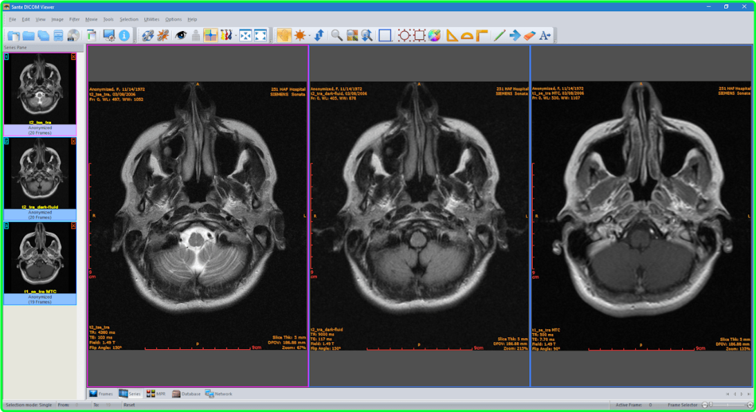 Sante DICOM Viewer Pro 14.0.6 RhEdvf4U_o