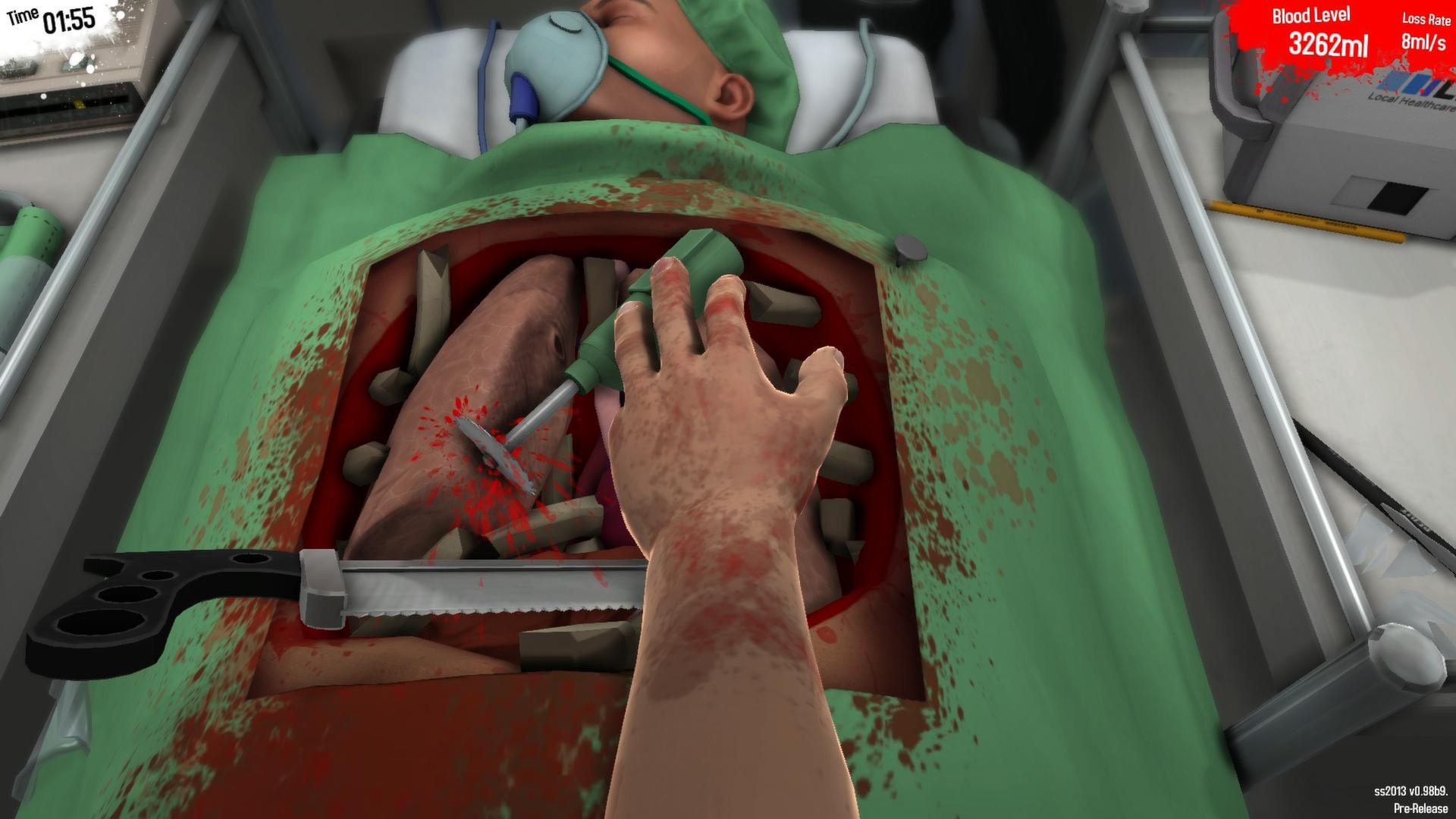 Surgeon Simulator 2013 Captura 1