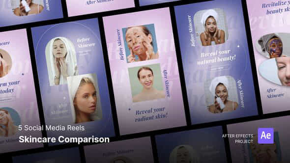 Social Media Reels Skincare Result Comparison After Effects Project Files - VideoHive 55392517