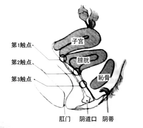 三个触点