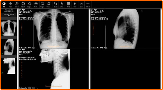 Fujidenolo Solutions SonicDICOM PACS 3.15.1 IzmfrXFb_o