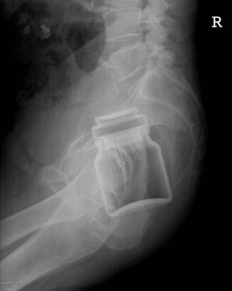 X-RAYS........... 2I7G2n19_o