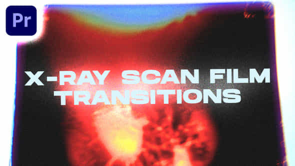 X-ray Scan Film - VideoHive 47814794