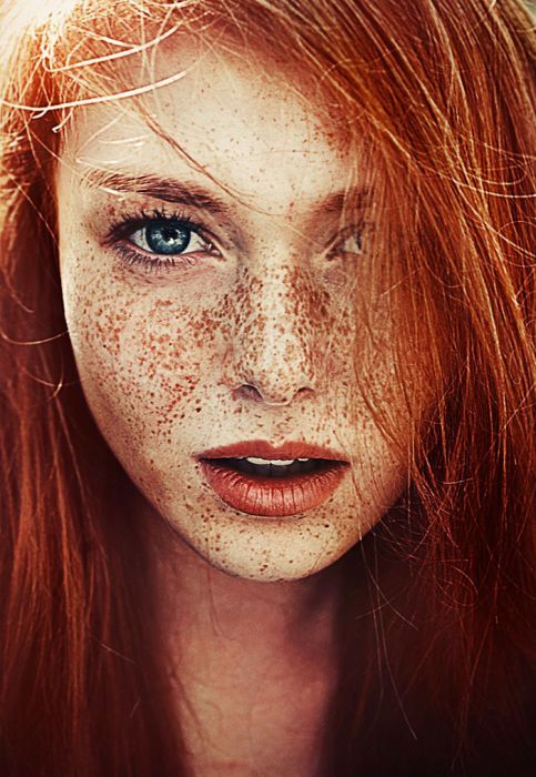 SEEING RED & FRECKLES...15 NUzYpZv3_o