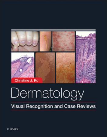 Dermatology   Visual Recognition and Case Reviews