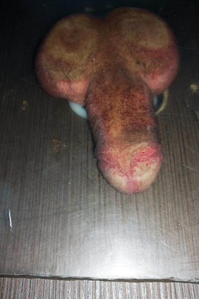 Dry skin on penis after sex-8734